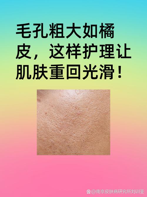 皮肤保养指南# 毛孔粗大如橘皮,这样护理让肌肤重回光滑!